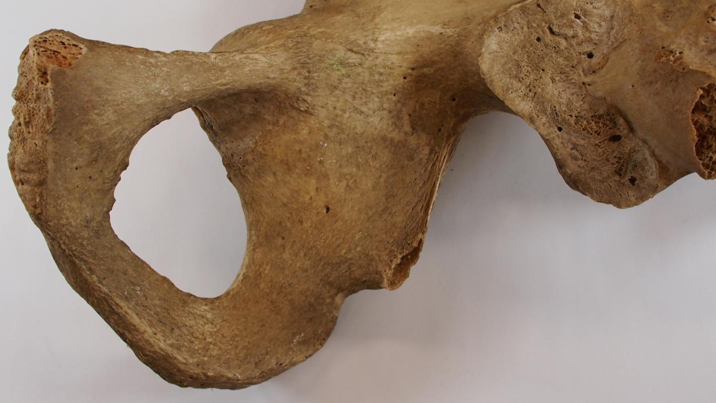 Pelvic Bone