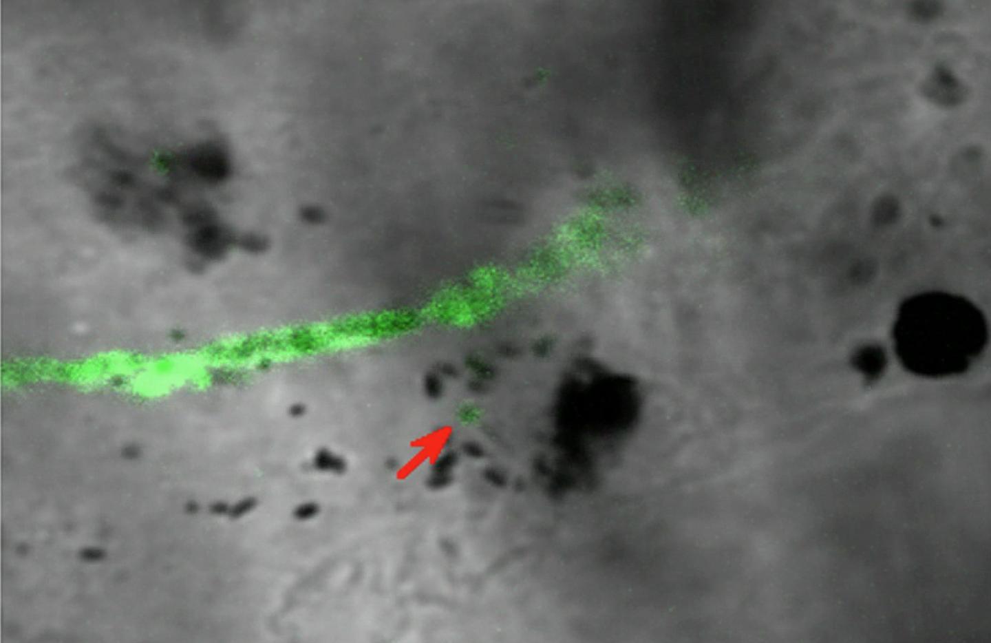 Melanin Migration (1 of 2)