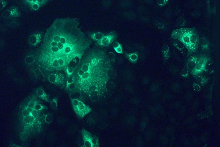 Monkey Kidney Cells Infected with MERS-coronavirus