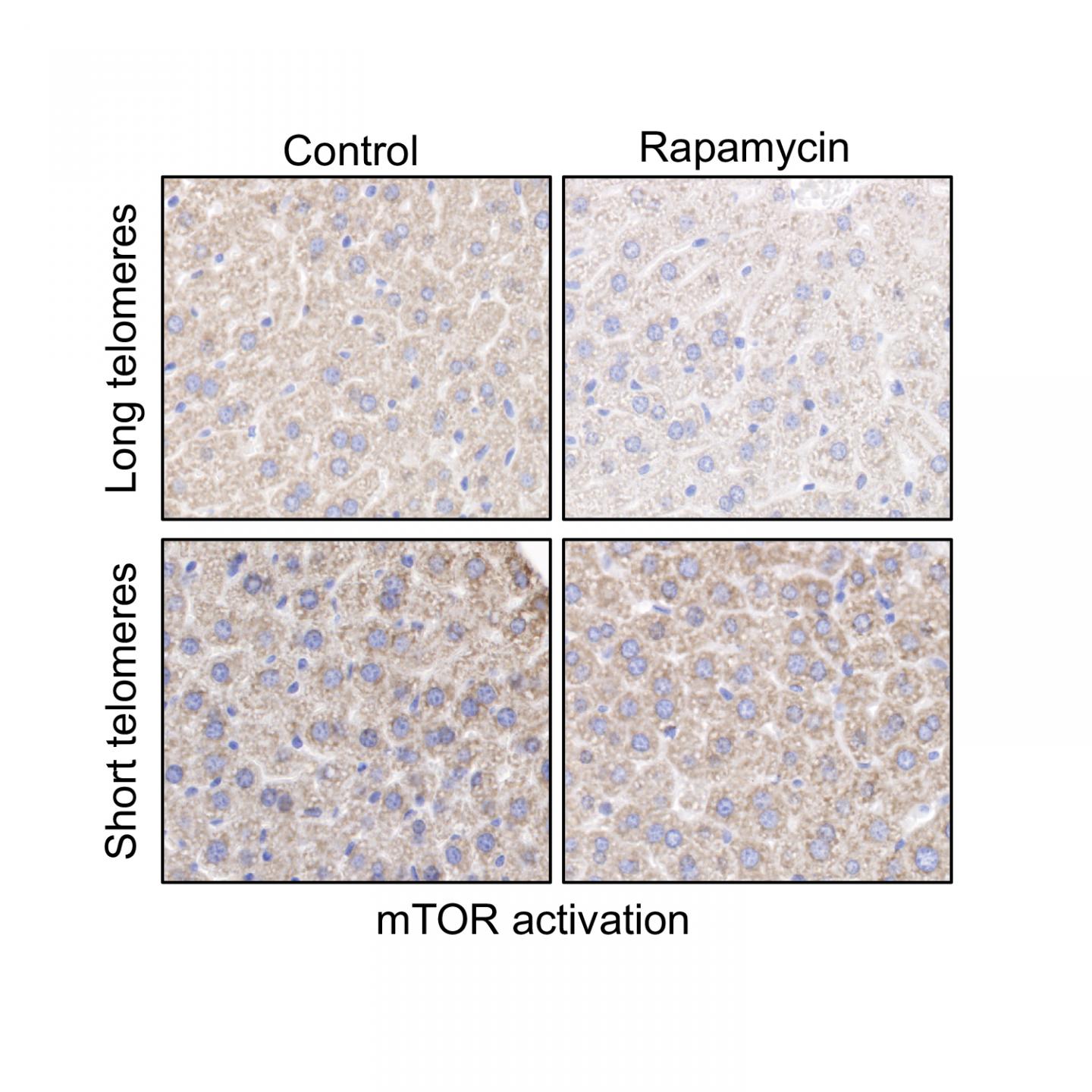 Inhibición de la actividad de mTOR en muestras de hígados de ratones