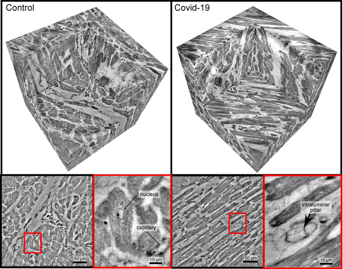 Heart tissue (healthy or affected by Covid-19)