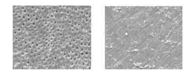 Erosive Tooth Wear from Sports Drinks