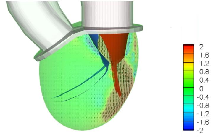 3-D Simulations of the Heart Mechanism