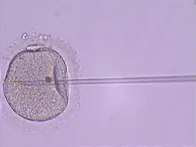 ICSI Method - Sperm is Injected into the Egg