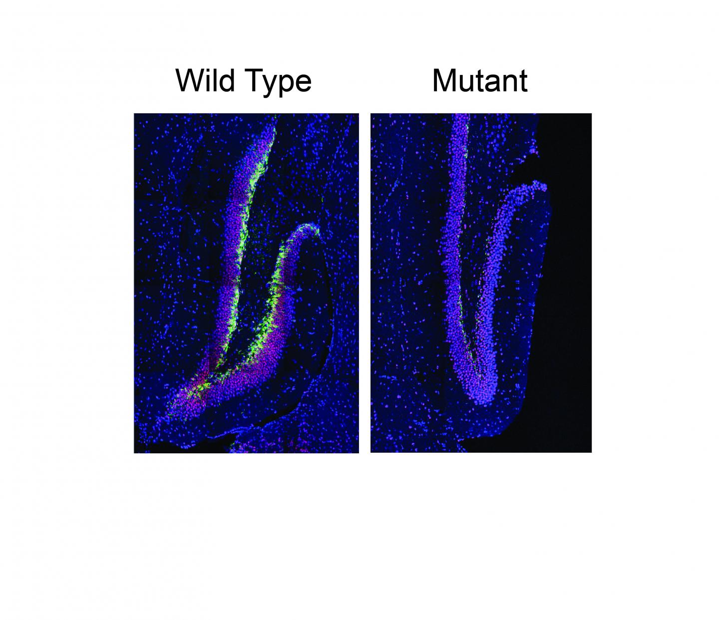 Growth in the Dentate Gyrus