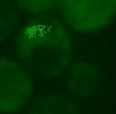 Protein Aggregate Tracks