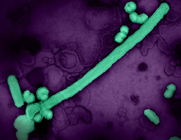 Colorized transmission electron micrograph of influenza A/H3N2 virus particles