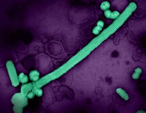 Colorized transmission electron micrograph of influenza A/H3N2 virus particles