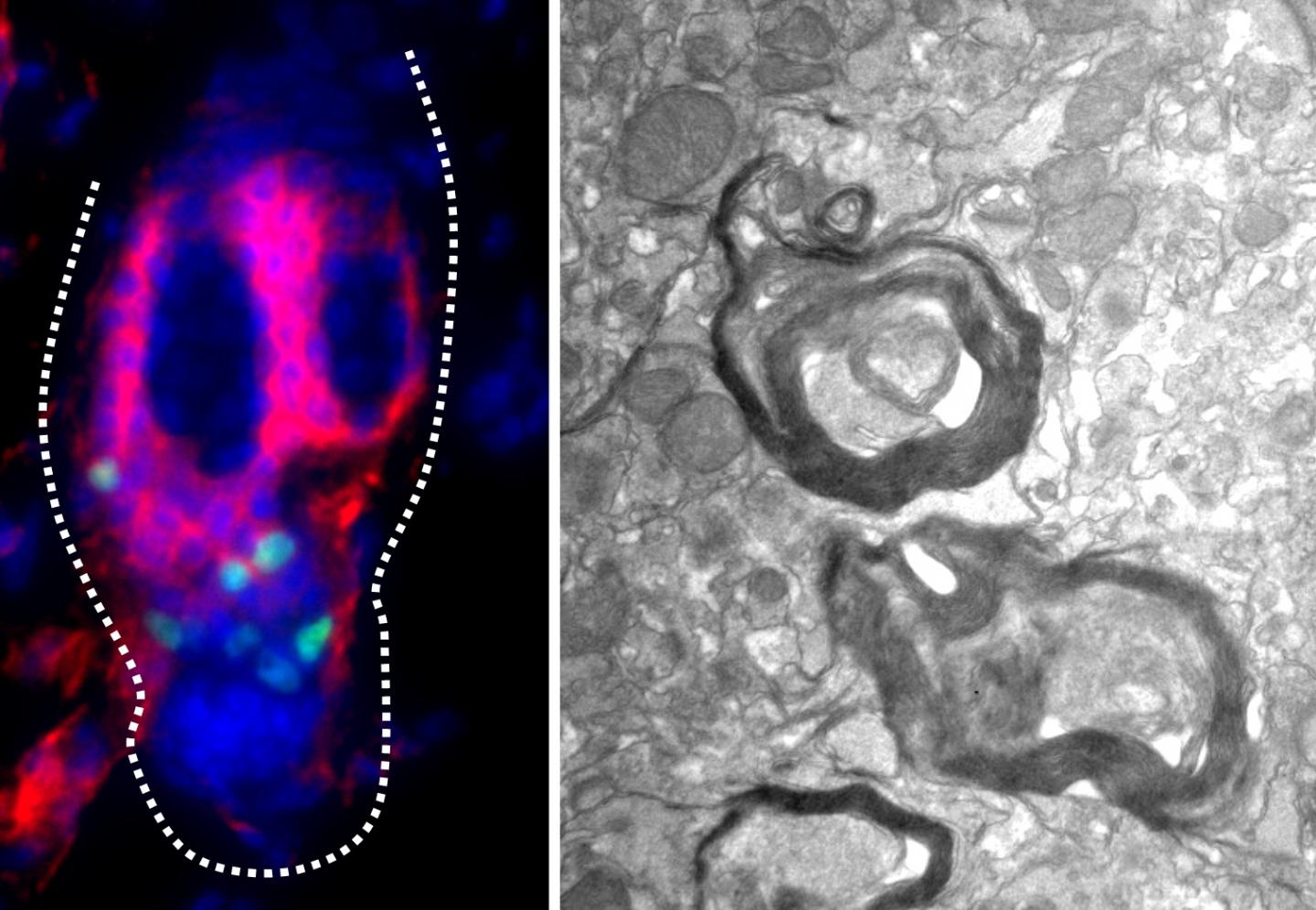 Stem Cells from Hair Follicles Have Potential to Repair Damaged Neurons in Mice