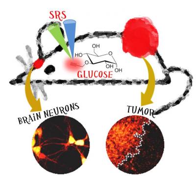Stimulated Raman Scattering Imaging of Glucose Uptake Activity