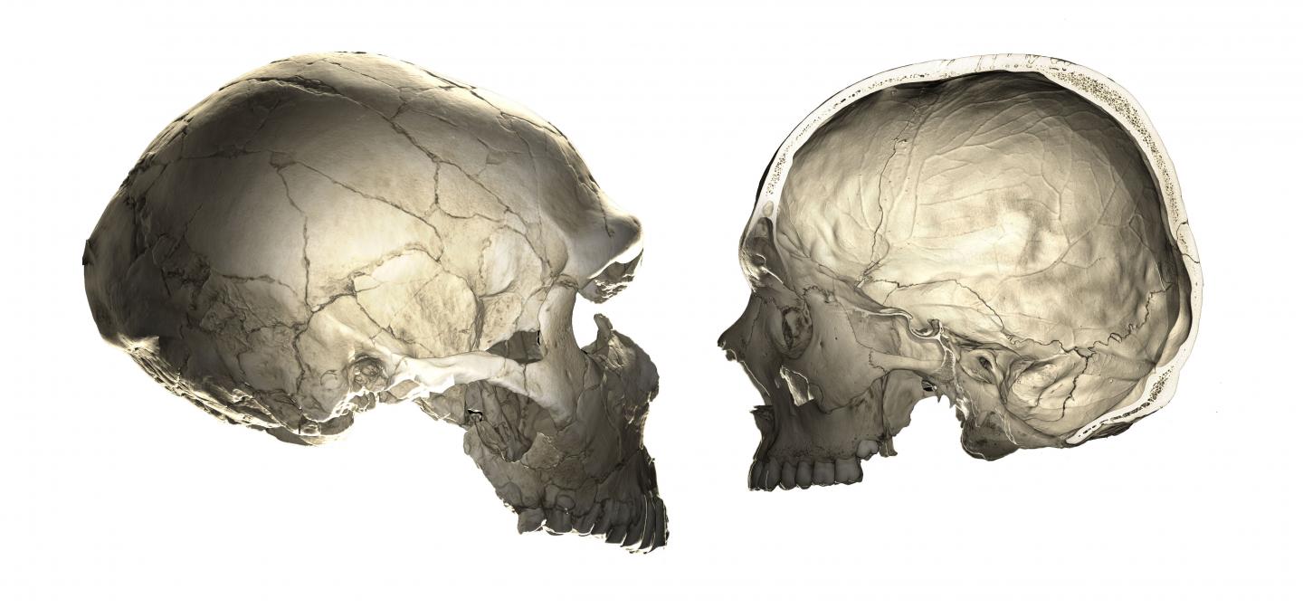 Human Versus Neandertal Braincase
