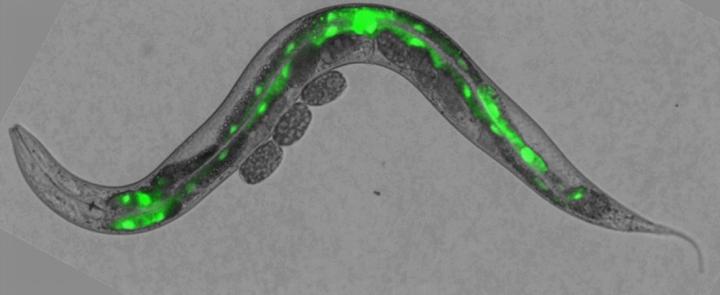 PIM Kinase