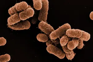 Electron micrograph of Klebsiella oxytoca