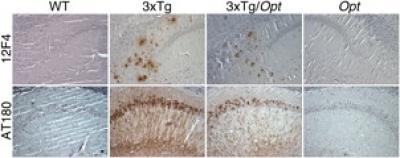 Amyloid-beta and Tau in Mouse Hippocamopus