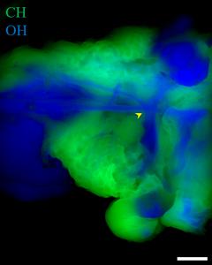 Team of NCT/UCC Dresden has once again received renowned funding from the Chan Zuckerberg Initiative. With their research, the team strives to improve imaging in deeper tissue layers.