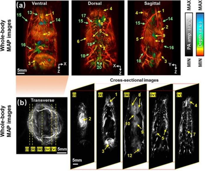 Whole-body image of a mouse captured using the developed photoacoustic computed tomography system