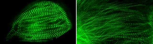 The Molecular Roots of Hypertrophic Cardiomyopathy