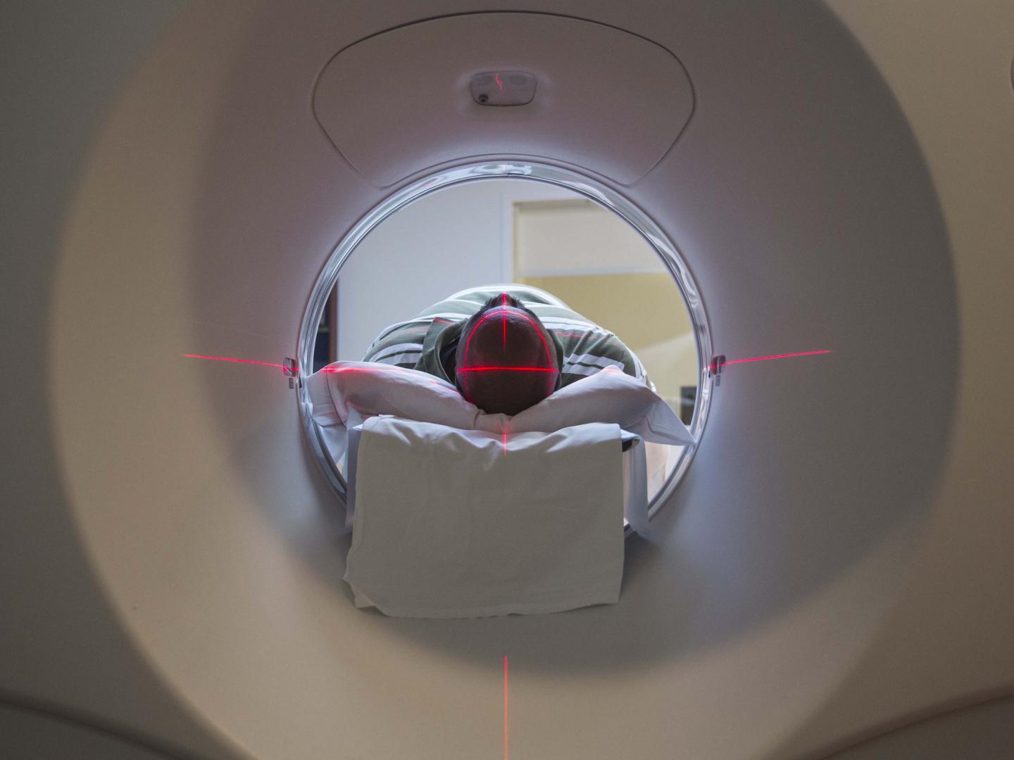 High-Risk Lung Cancer Patients May Not Need Annual Screenings