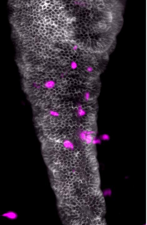 How The Microbiota Controls Neutrophil Activity
