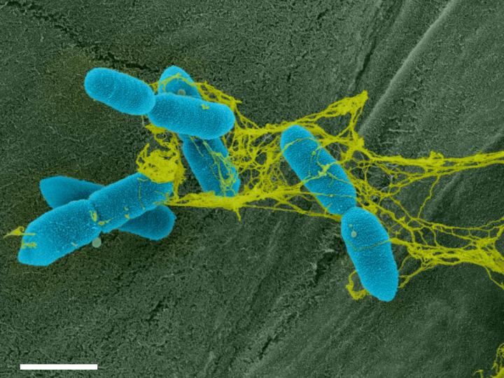 The Arms Race at the Plant Root: How Soil Bacteria Fight to Escape Sticky Root Traps