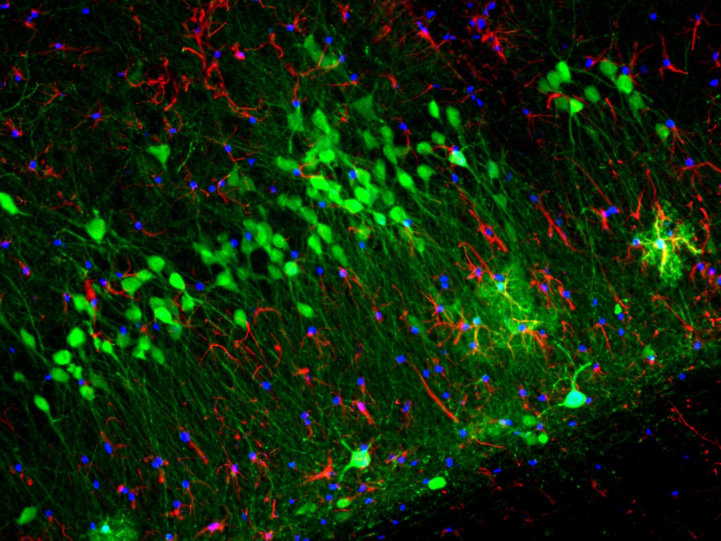 Physical Positioning Dramatically Enhances Brain Transduction After Intrathecal AAV9 Infusion (4-7)