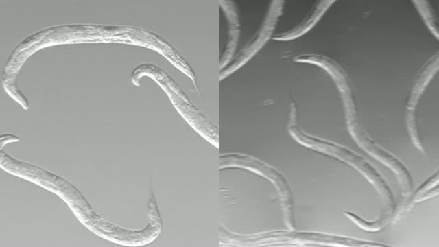 Removing TCER-1 Improves Mobility in Worms Paralyzed by Toxic Buildup of Amyloid Beta Protein