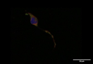 A cell grown in the absence of vitamin D