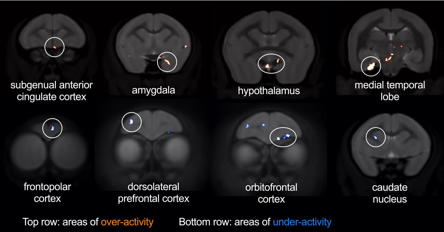 Brain regions affected by sgACC over-activity during threat