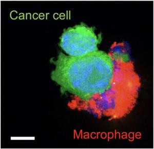 Nano-Immunotherapy helps the immune system attack and destroy cancer cells