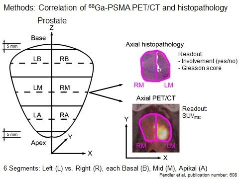 Correlation of Ga-68-PSMA PET/CT and Histopathology