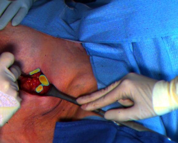 Lymph Node Identification