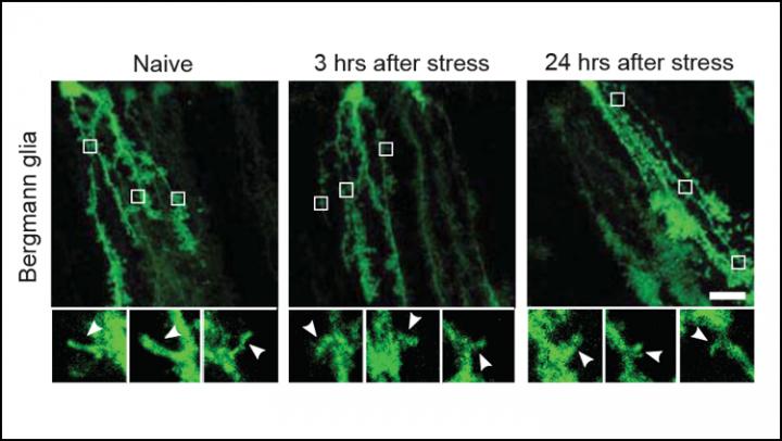 How Stress Remodels the Brain
