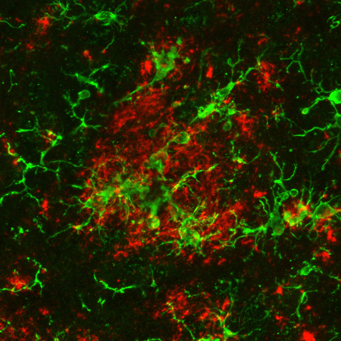 Microglia and beta amyloid