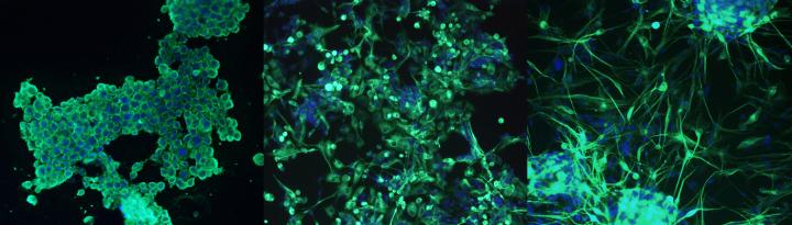 Glioblastoma Stem Cells