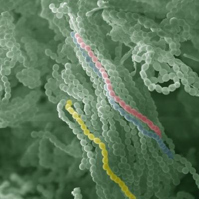 <i>Penicillium</i> Spores