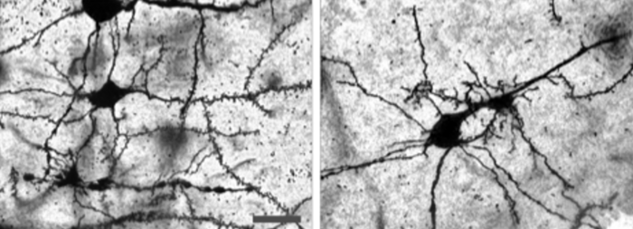 Effect of sleep deprivation stress on SLE-like mouse neurons