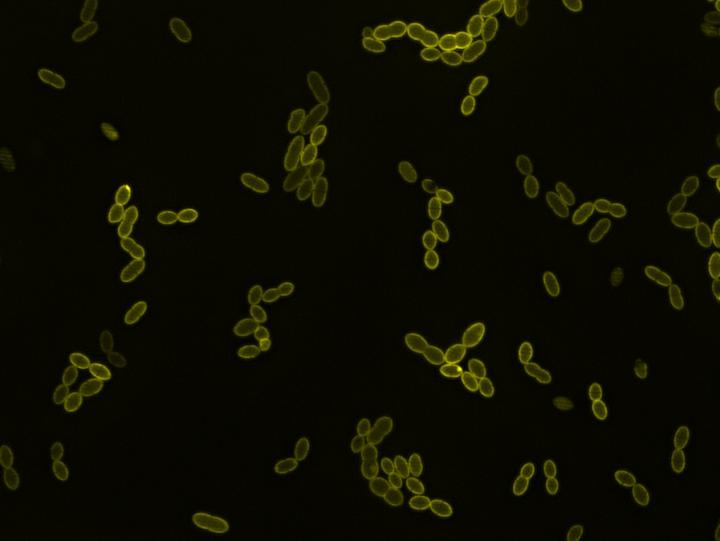 Streptococcus pneumoniae cells expressing fluorescent MurM and MurN