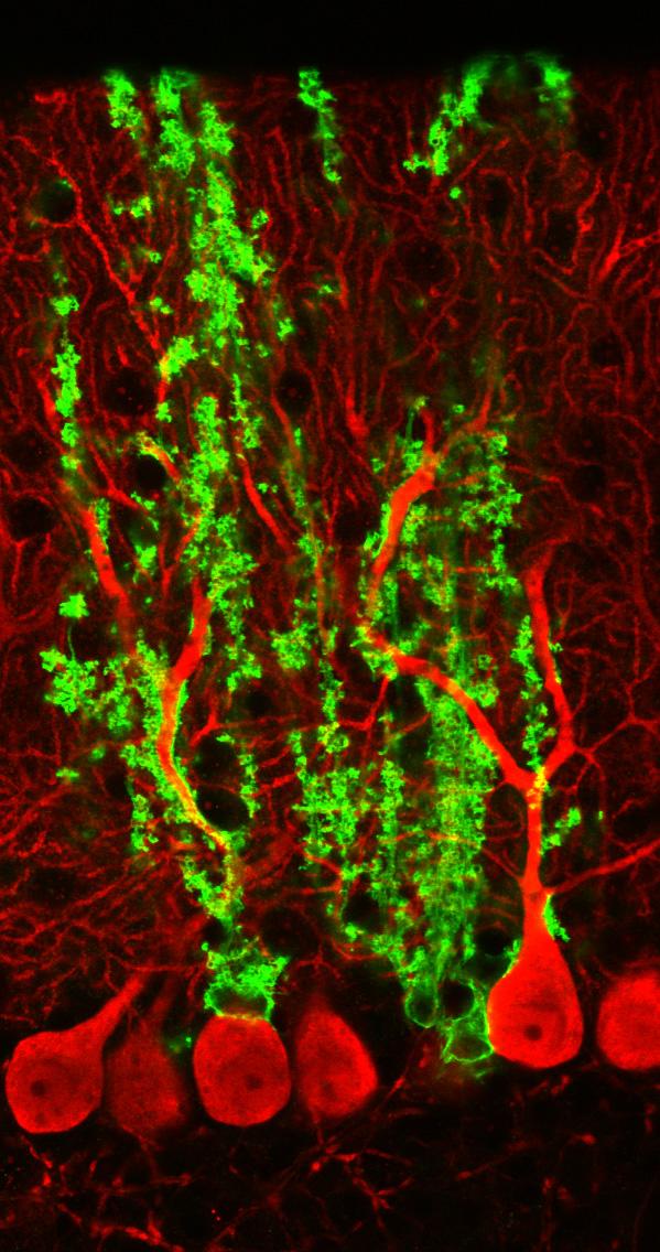Microscope Image Showing the Intimate Association between Astrocytes and Neurons in the Mouse Cerebe