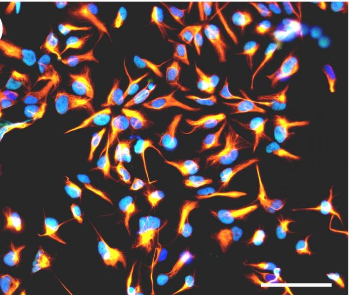 What Viruses Do to Neuronal Stem Cells