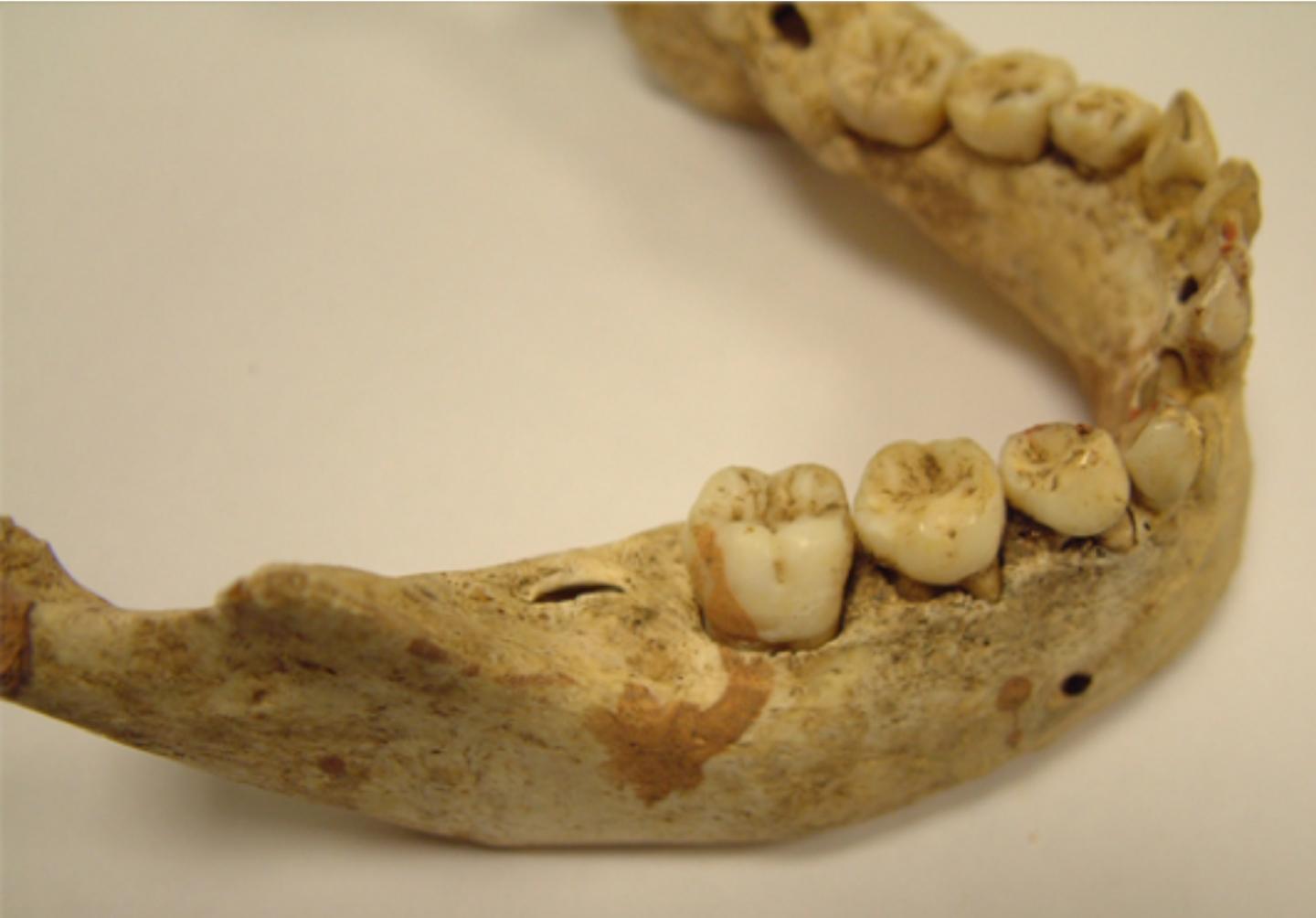 Medieval Milk Teeth