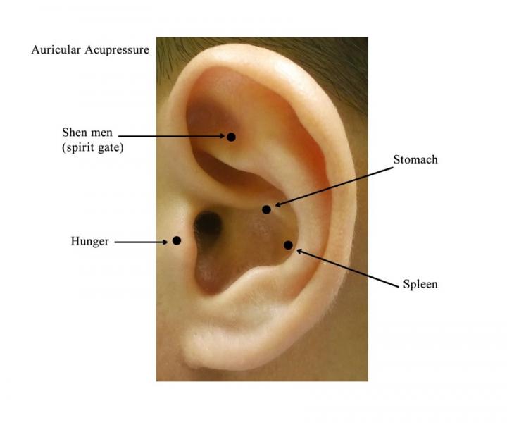 HKBU-acupuncture-2