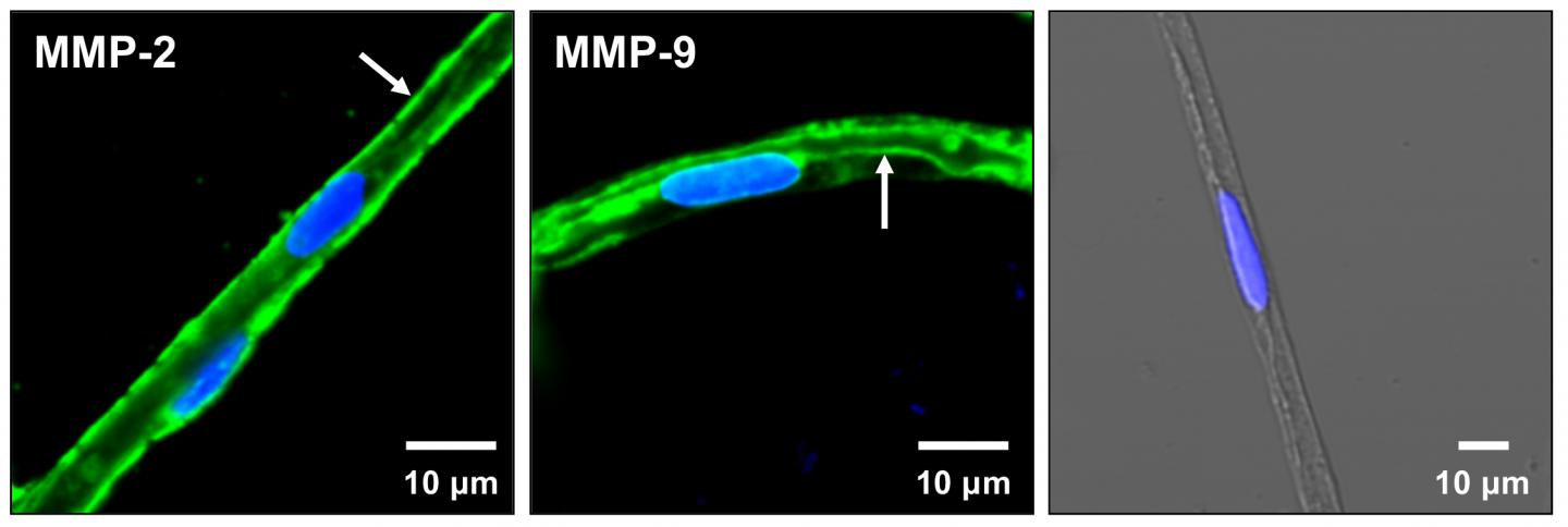 MMP-2, MMP-9