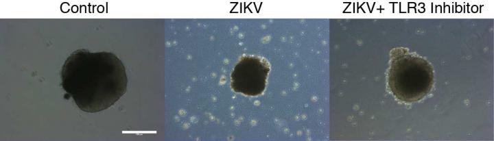 Zika-Infected Brain Organoid with TLR Inhibitor
