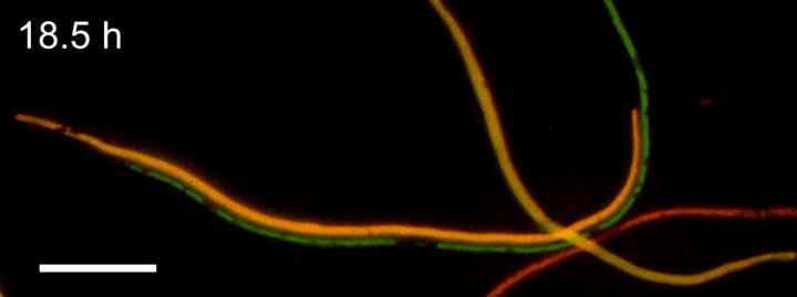 Toxic ROS and General Stress Response in Bacteria Exposed to Antibiotics