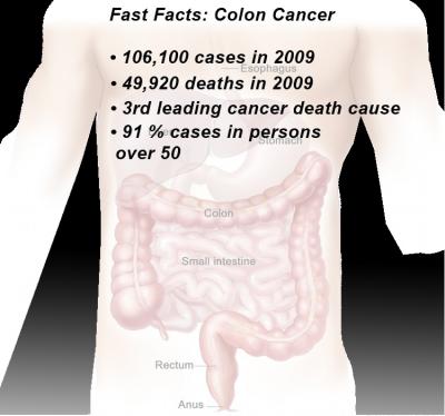 Colon Cancer Biomarkers