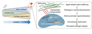 Graphical Abstract of Mechanism Driving Knee Osteoarthritis