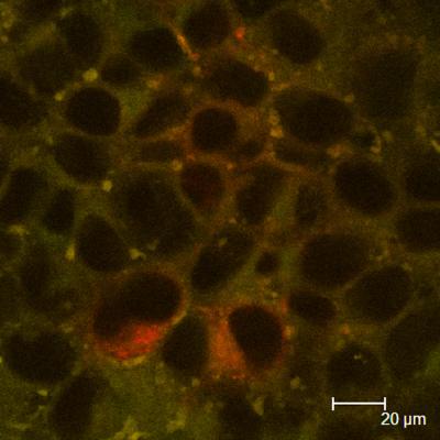 Researchers Show Influence of Nanoparticles on Nutrient Absorption