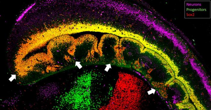 University of Barcelona team rejuvenates brain neurons through cellular reprogramming: more neurons and more brain plasticity