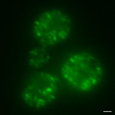 Yeast Cells with GFP and Amyloids