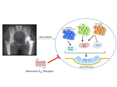 Drug Blocks Implant Bone Damage 